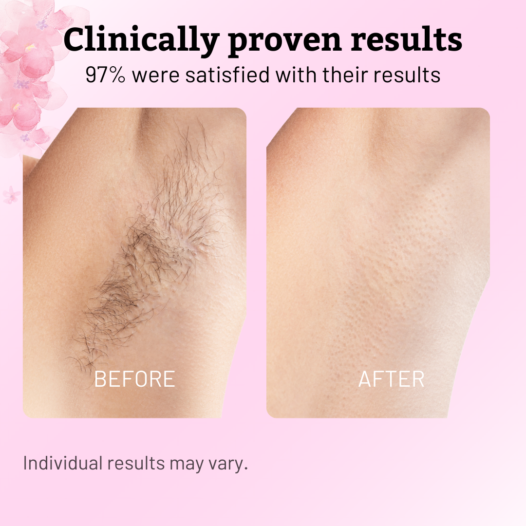 Caramela Beauty Cyperus Rotundus Oil for Natural Permanent Hair Reduction