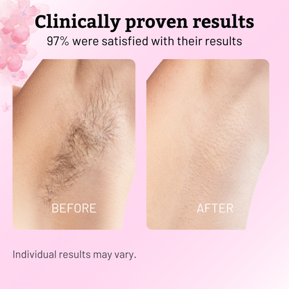 Caramela Beauty Cyperus Rotundus Oil for Natural Permanent Hair Reduction