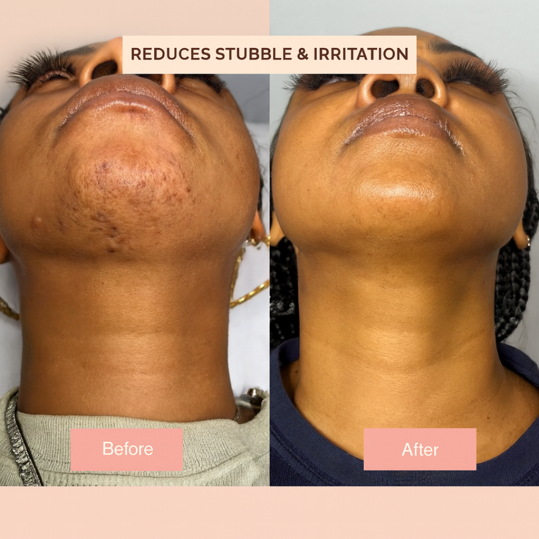 Cyperus Rotundus Skin Serum